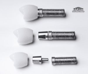 dental implants comprehensive guide