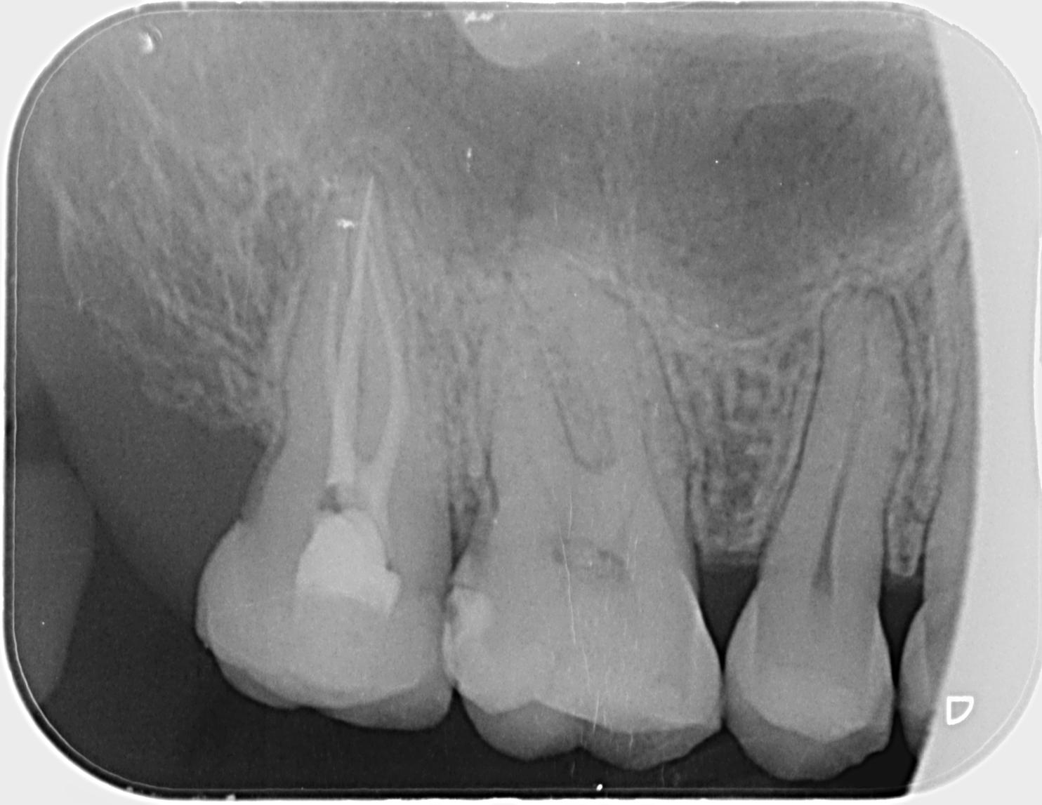 Dental x-rays at your dentist