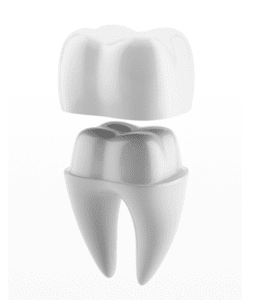 Dental crown Brisbane