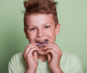 Occulusal splint mouthguard